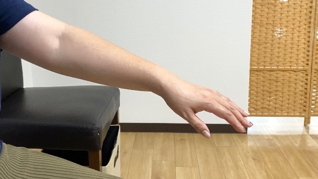 関節リウマチ患者の手指