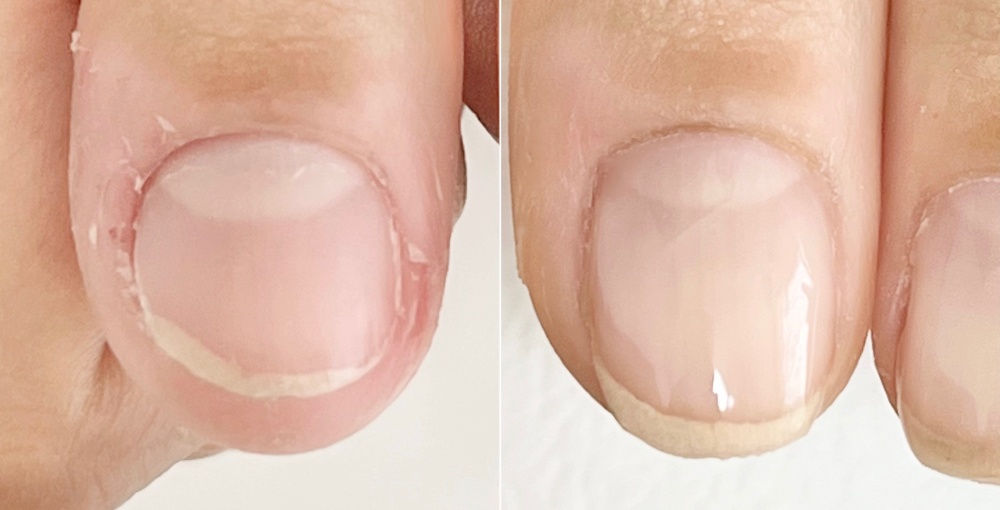 むしり癖だったけどお爪をのばせるように