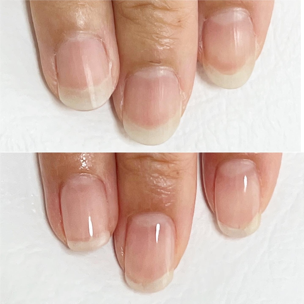 自爪育成深爪育成深谷市