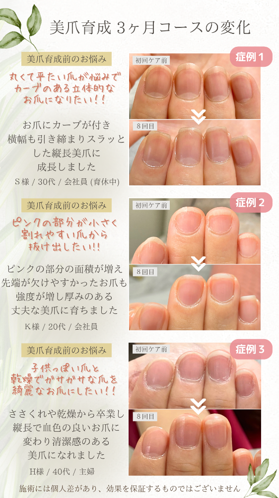 美爪育成3ヶ月コース後の変化