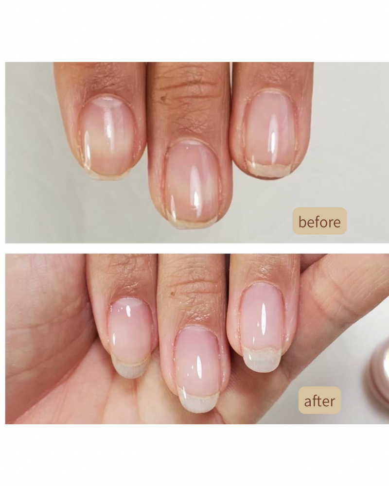 自爪育成のビフォー/アフター写真