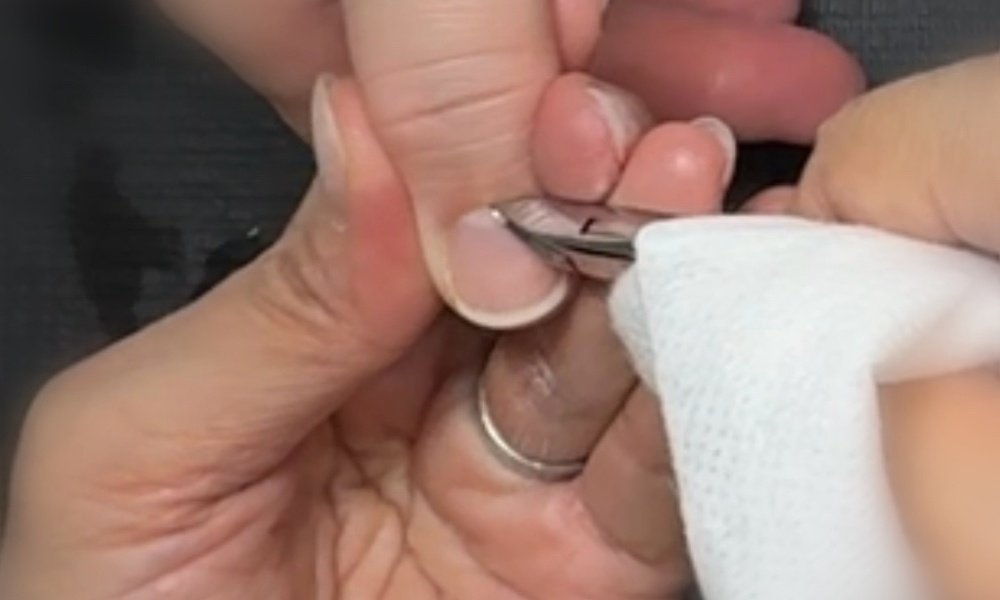 ネイルのキューティクルニッパーでケアしている写真