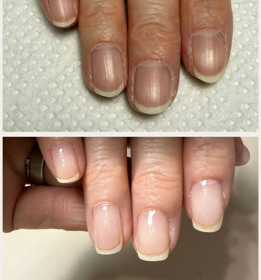自爪育成のビフォー/アフター写真