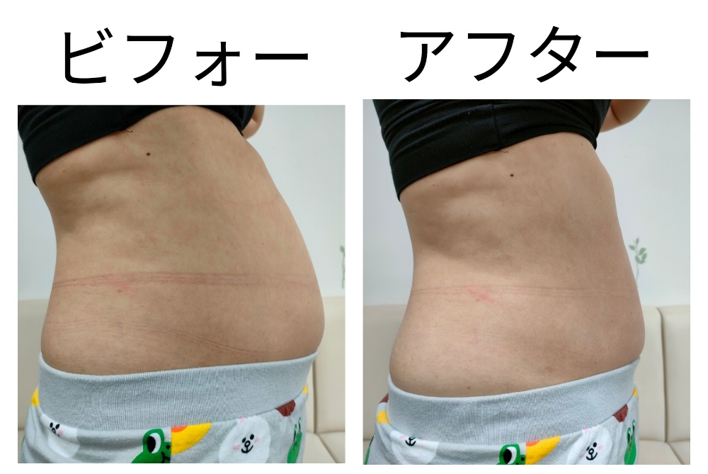 オイル整体（ミドル）90分