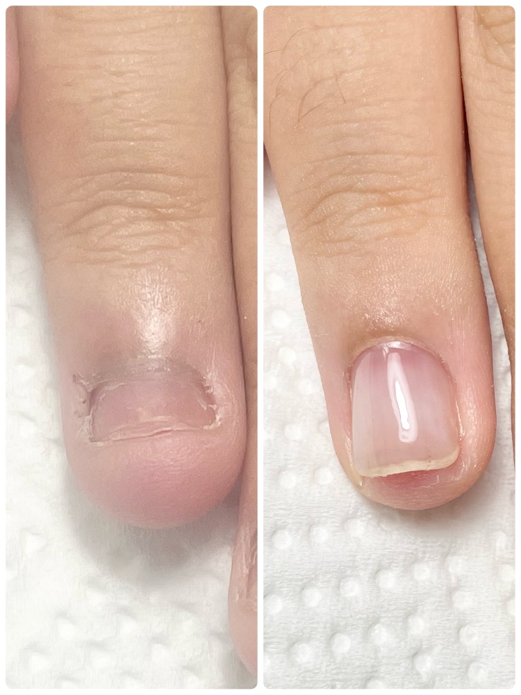 宮城県仙台市太白区自爪育成ネイルサロン　nail&eye MOMO ネイル画像