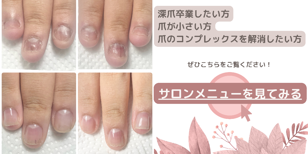宮城県仙台市太白区自爪育成ネイルサロン　nail&eye MOMO 画像