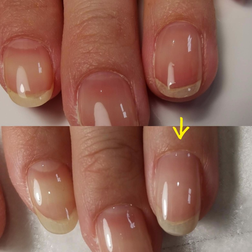 爪が痛むネイルサロン と 爪が育つネイルサロン どちらがいいですか 爪が生き返る Irodori Nail 岐阜県瑞穂市