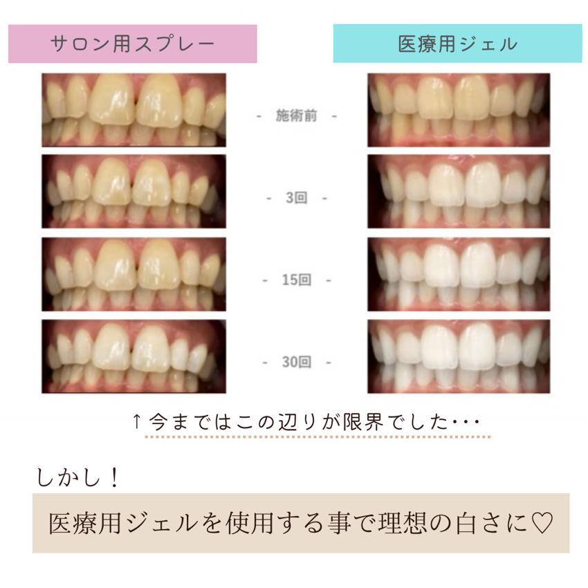 セルフホワイトニング - オーラルケア