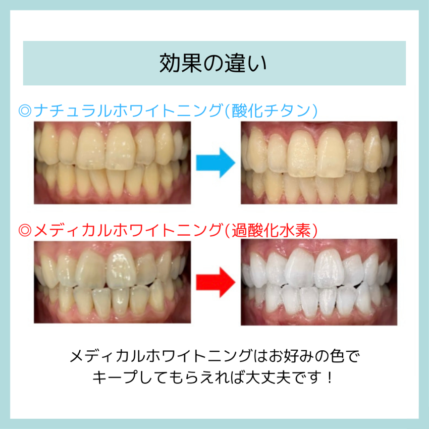 セルフホワイトニング - 救急