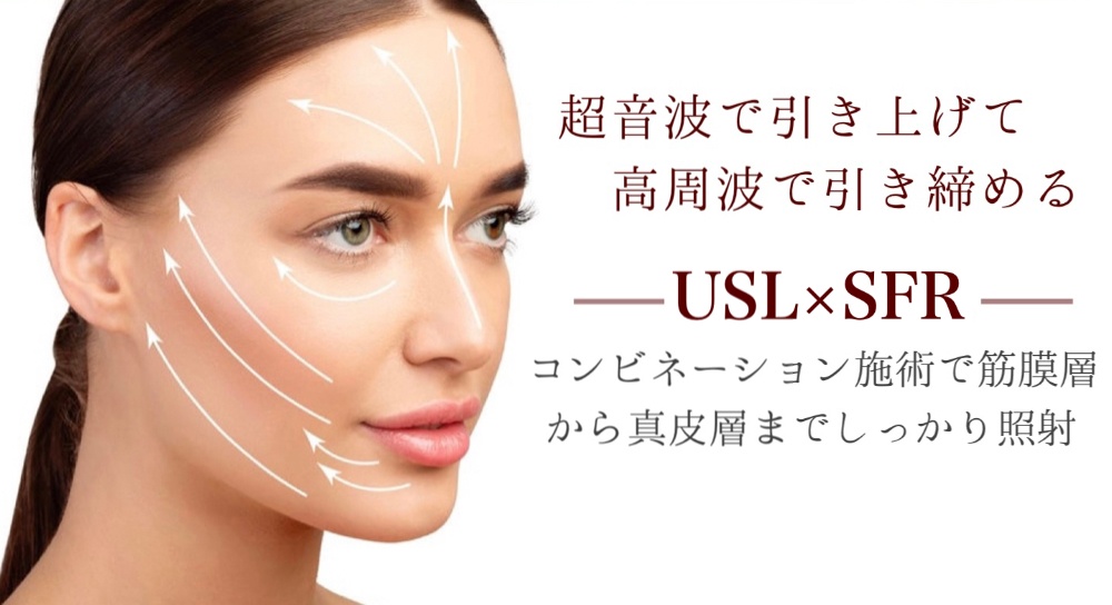 リフトアップ　高周波　小顔　フラクショナル RF 美肌フラクショナルRF・コラーゲンリフトアップ | 佐々木皮膚科