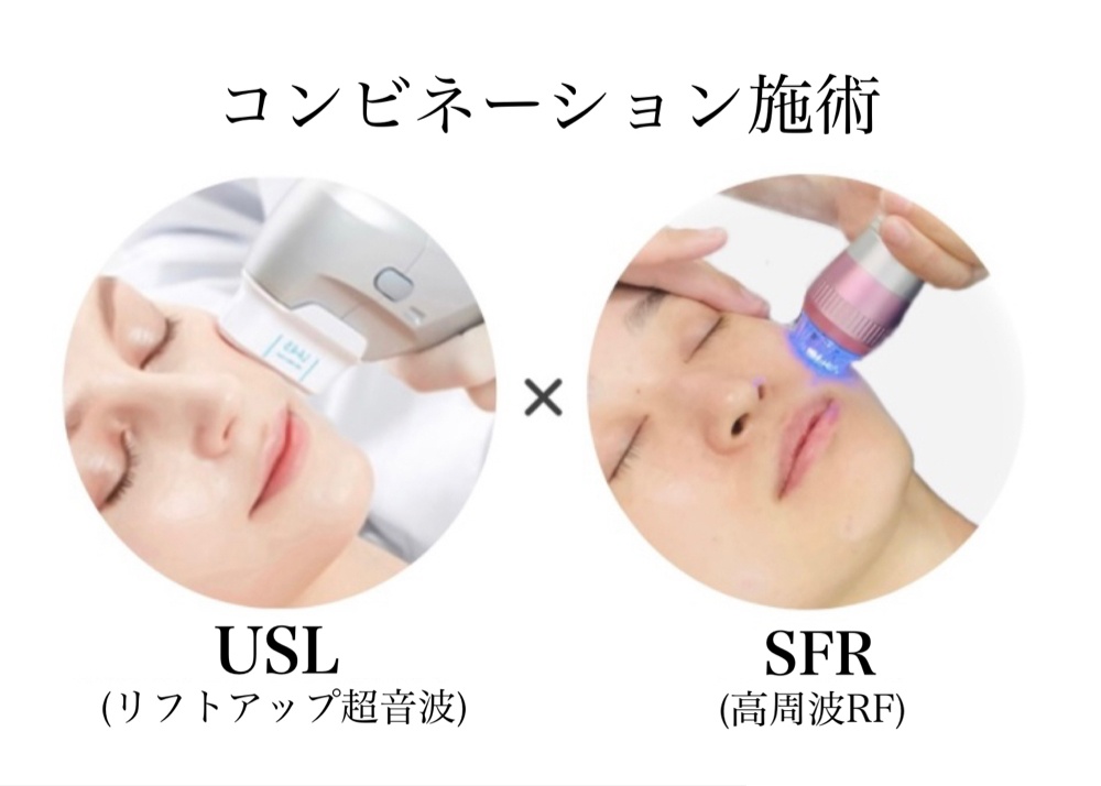 たるみ改善・リフトアップ・小顔(USL×SFR)) | パンダ整骨院