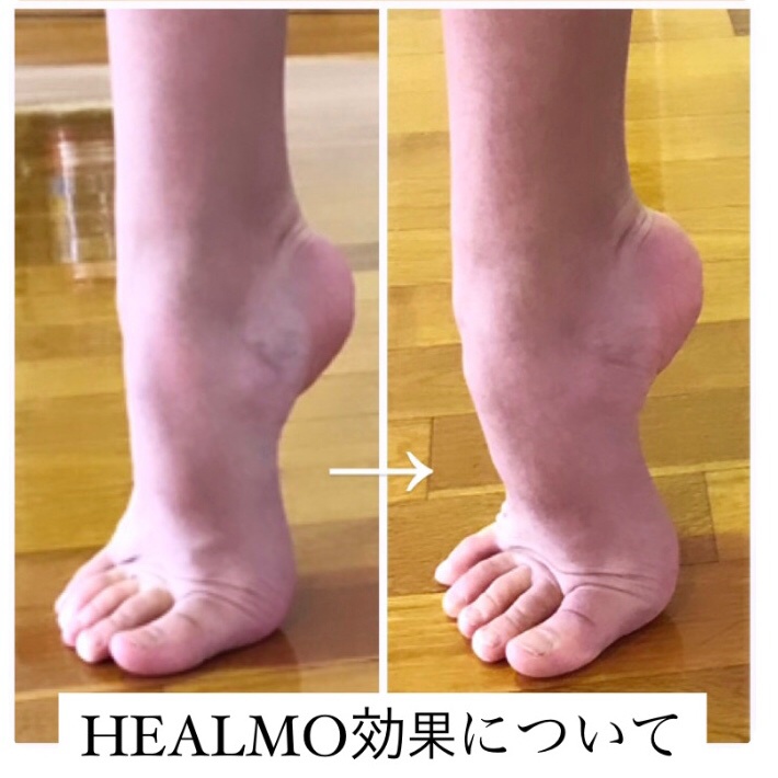 日本限定モデル】 Healmo 足首関節のストレッチで美しいアーチ