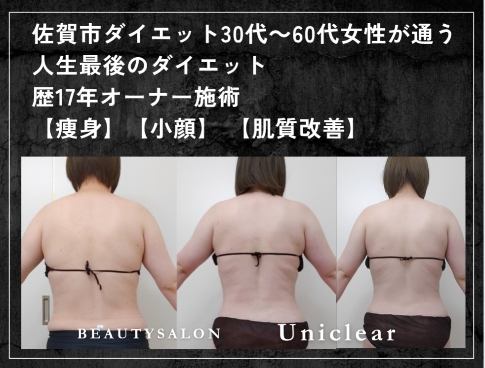 佐賀市で痩身ダイエット