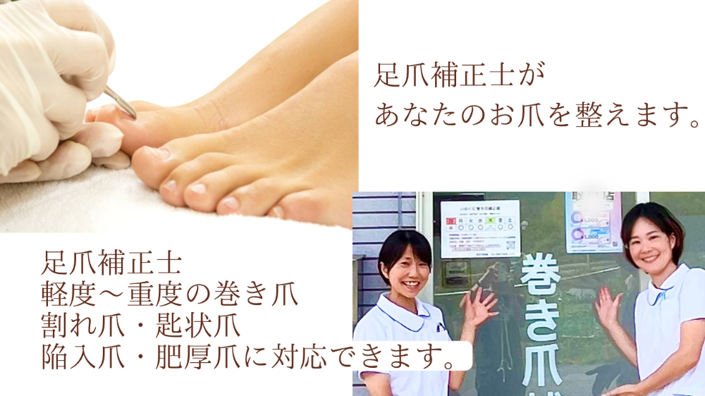 山口県で足の爪のケアをしているサロンです。岩国市、柳井市、熊毛郡、下松市、光市、周南市など訪問での足爪ケアも承っています。爪切り、肥厚爪、巻き爪など足の爪に関することはお任せください。