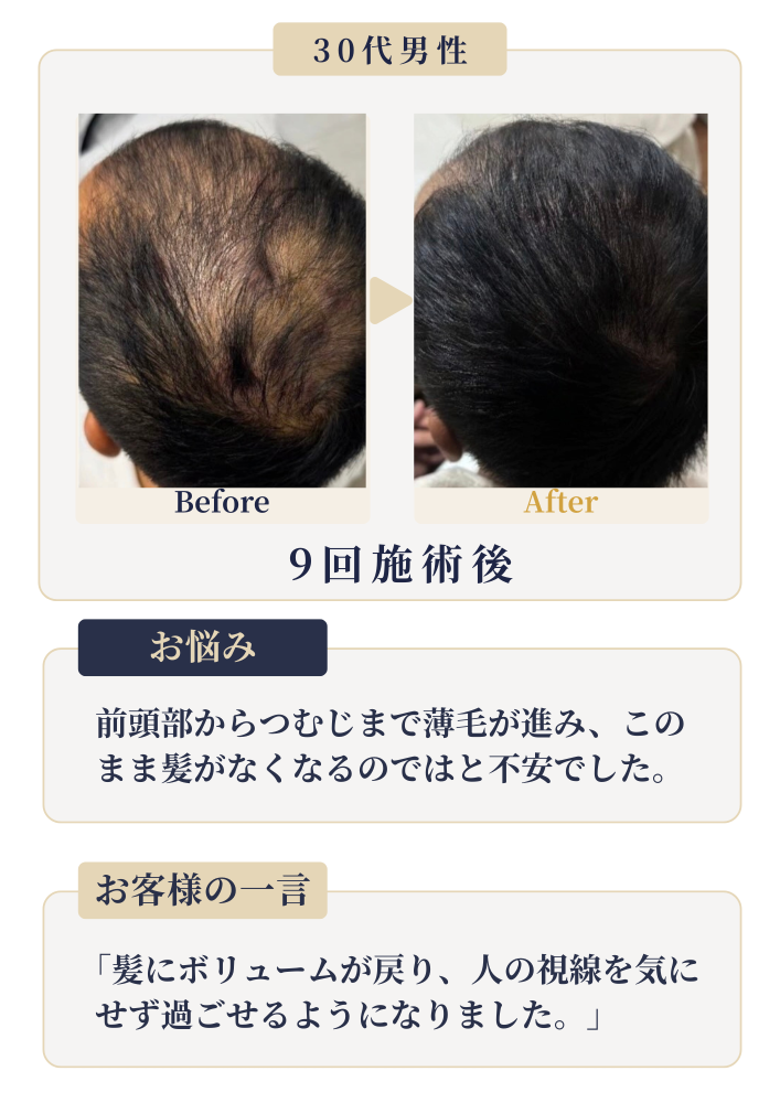 境港・米子の発毛育毛スカルプ専門サロン｜セトラクション