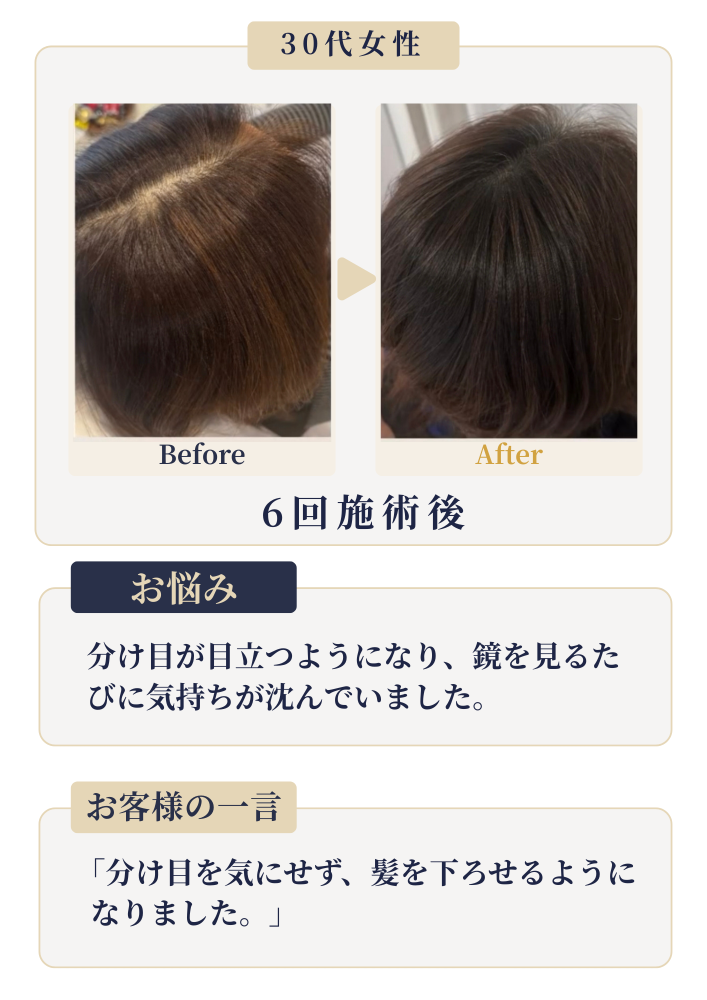 境港・米子の発毛育毛スカルプ専門サロン｜セトラクション