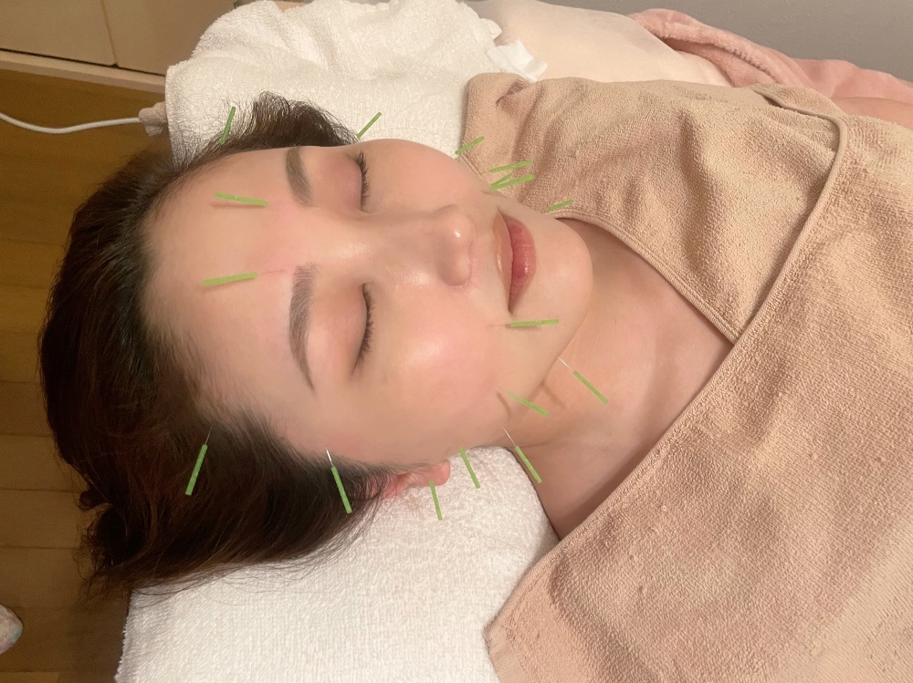 新・美容鍼灸ショートコース