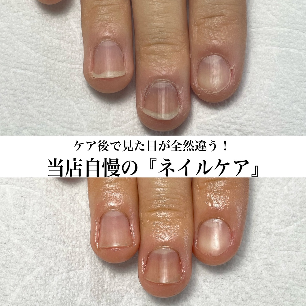 最強ネイルケア