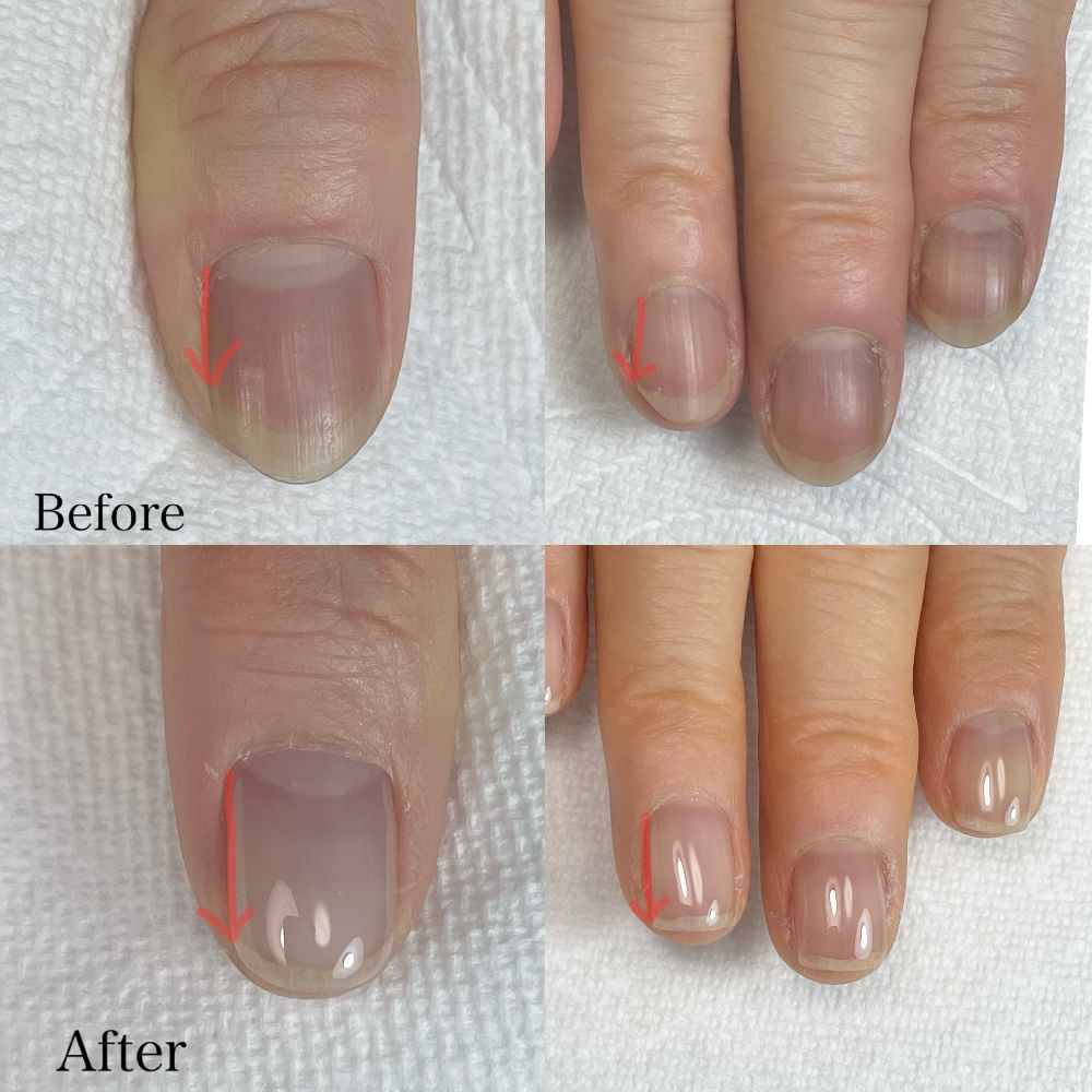 岡崎市自爪育成ネイルサロン