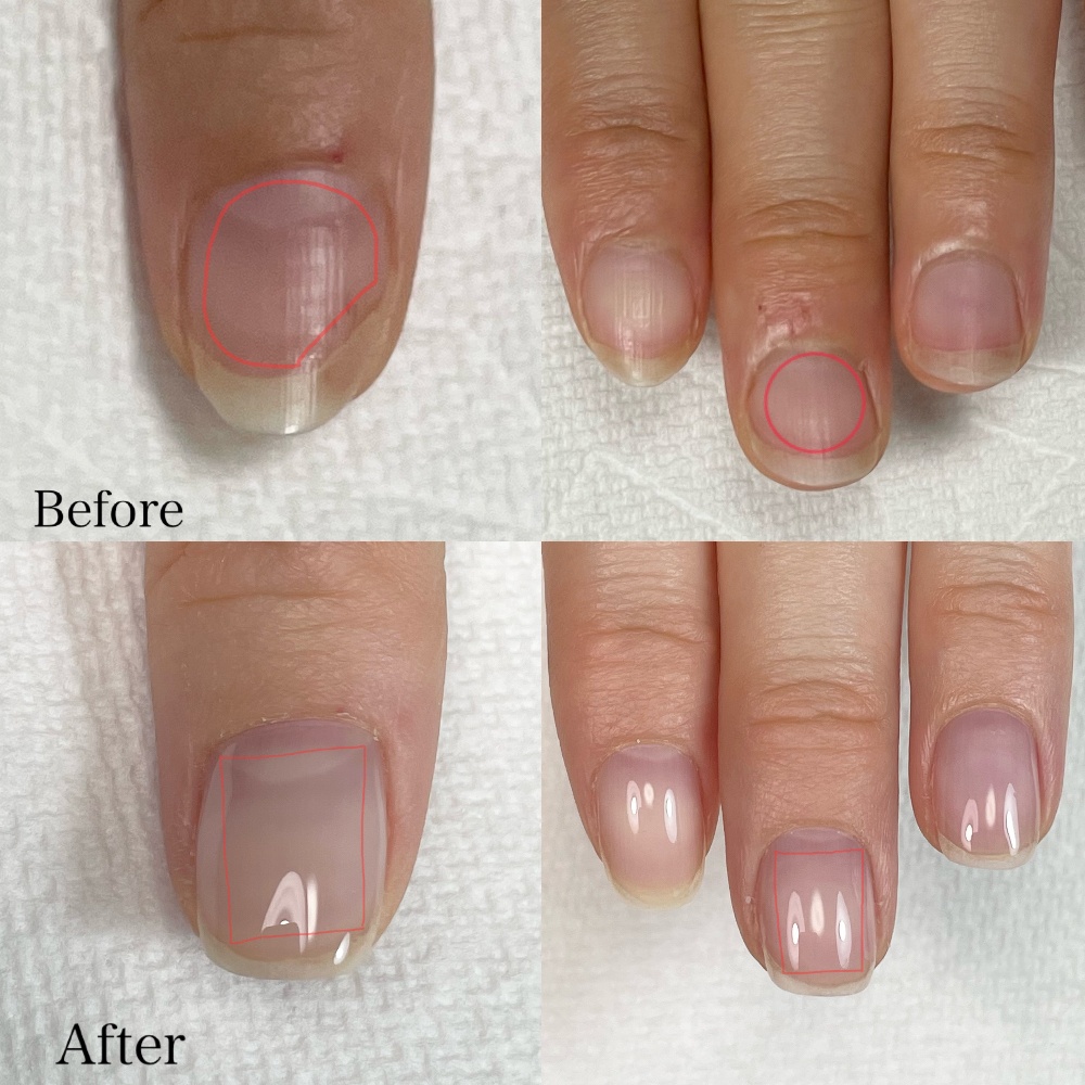 岡崎市自爪育成ネイルサロン