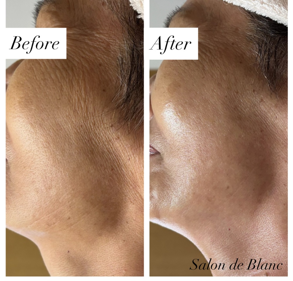 浜松市のアロマテラピーとアロマリンパマッサージならサロンドブラン